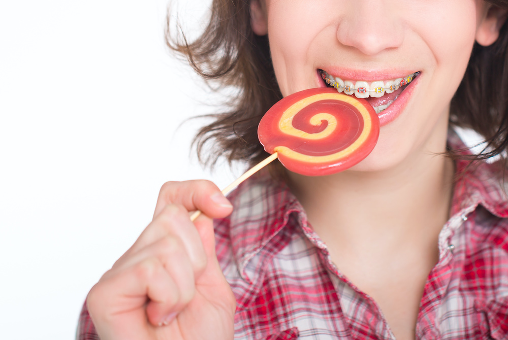 Young woman with multi-colored bracket system and candy, stressing the importance of what you can and can't eat with braces.